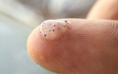 microbead